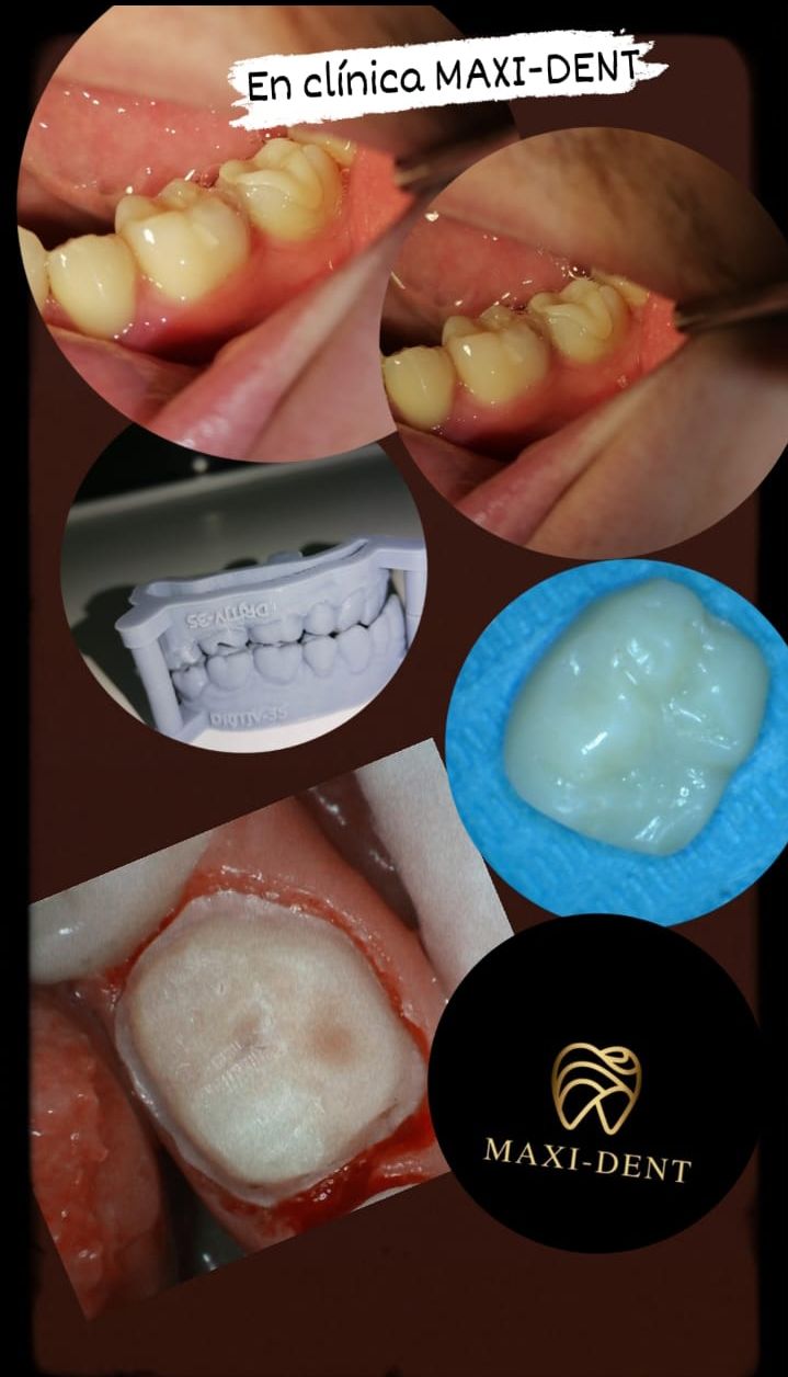 Jose David Torres Hernandez-6