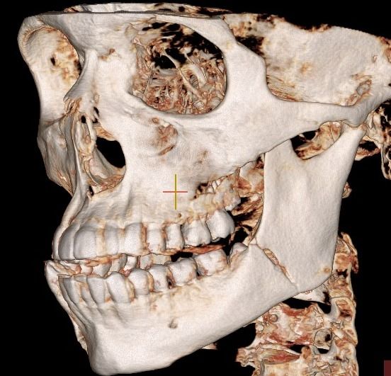 Sergio Fernando García Aguilar-4