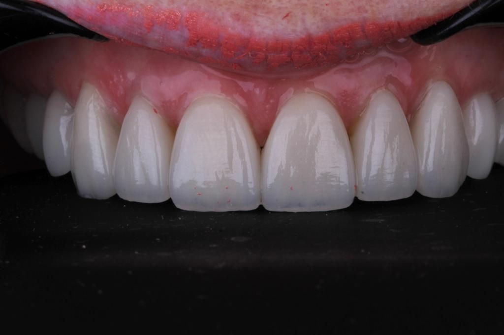 Josué Márquez Gómez-145