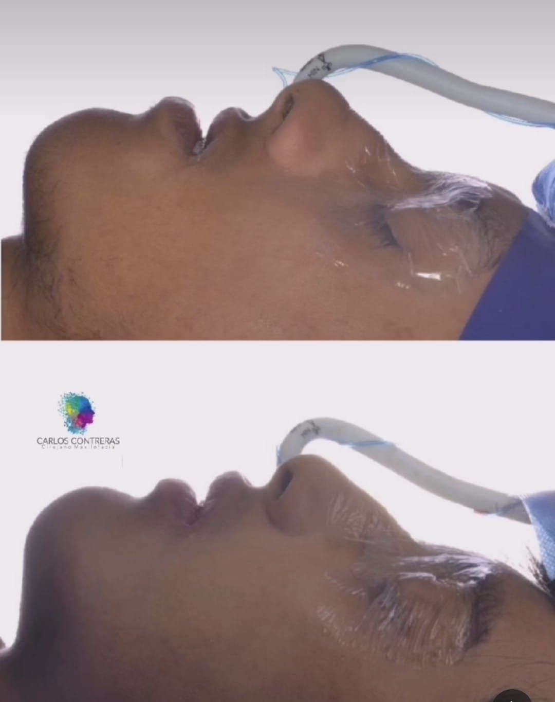 Carlos Ernesto Contreras Castellanos-10