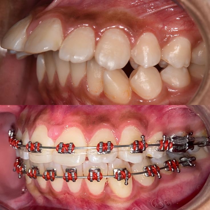 Gloria Haydee Castillo Castellanos-4