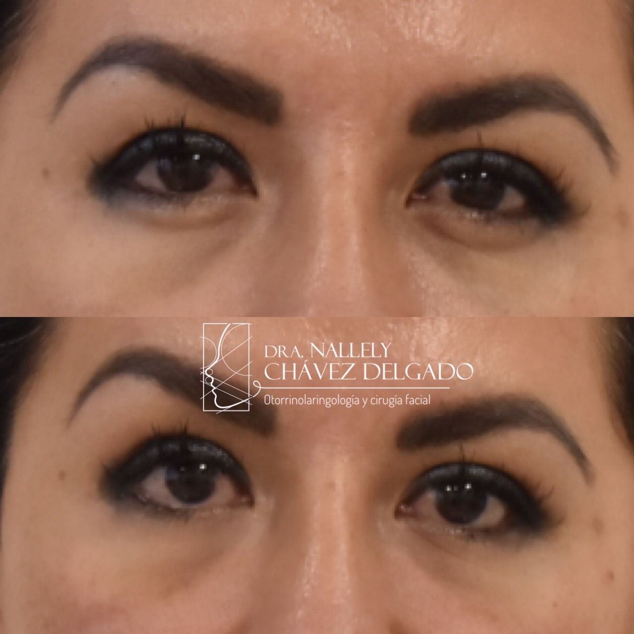 Nallely Chávez Delgado-13