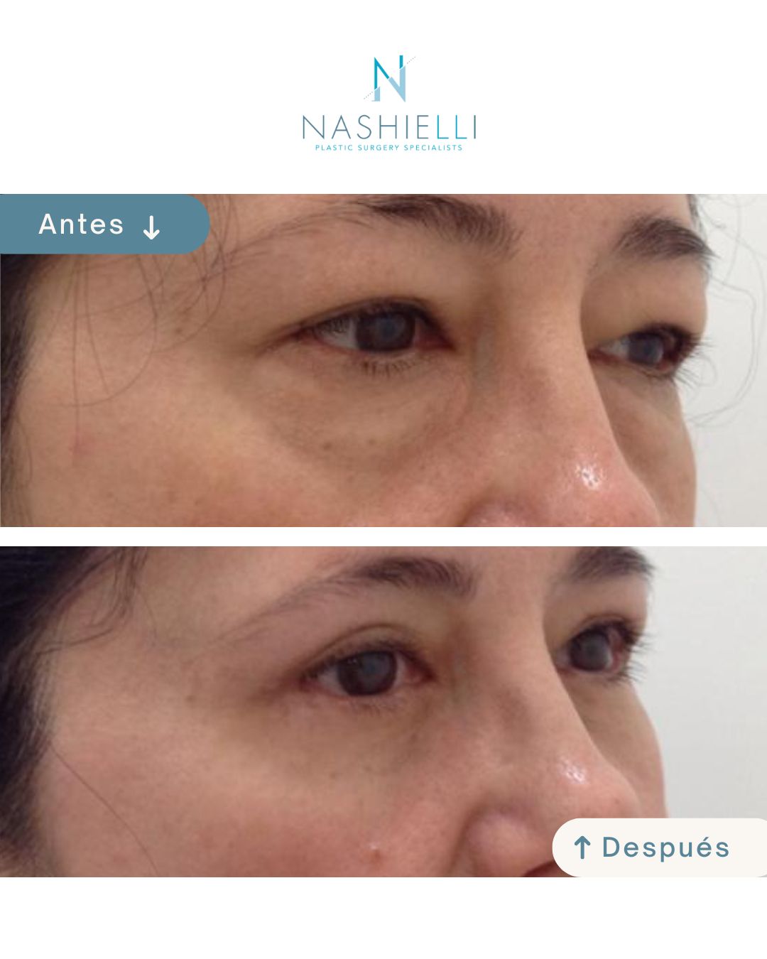 Nashielli Torres Espinosa Chiu-35