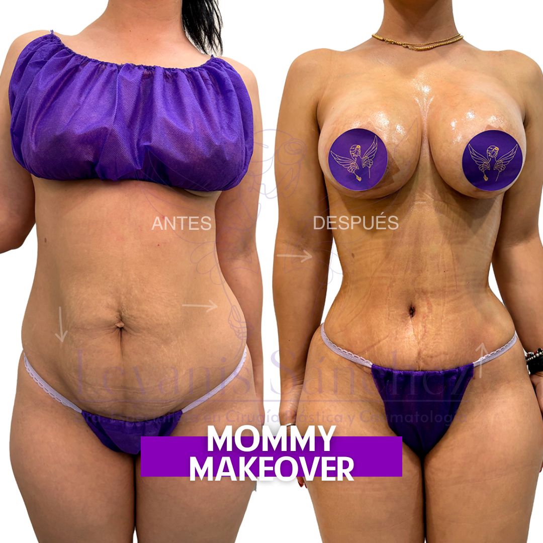 Leyanis Sánchez Hidalgo-9