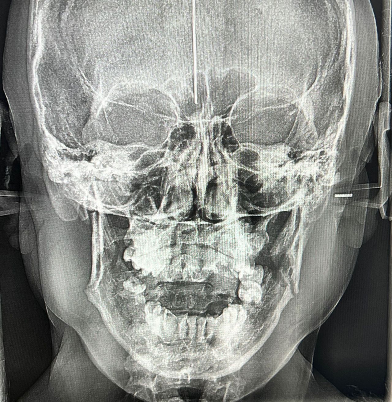 Luis Enrique Cruz Hernández-36