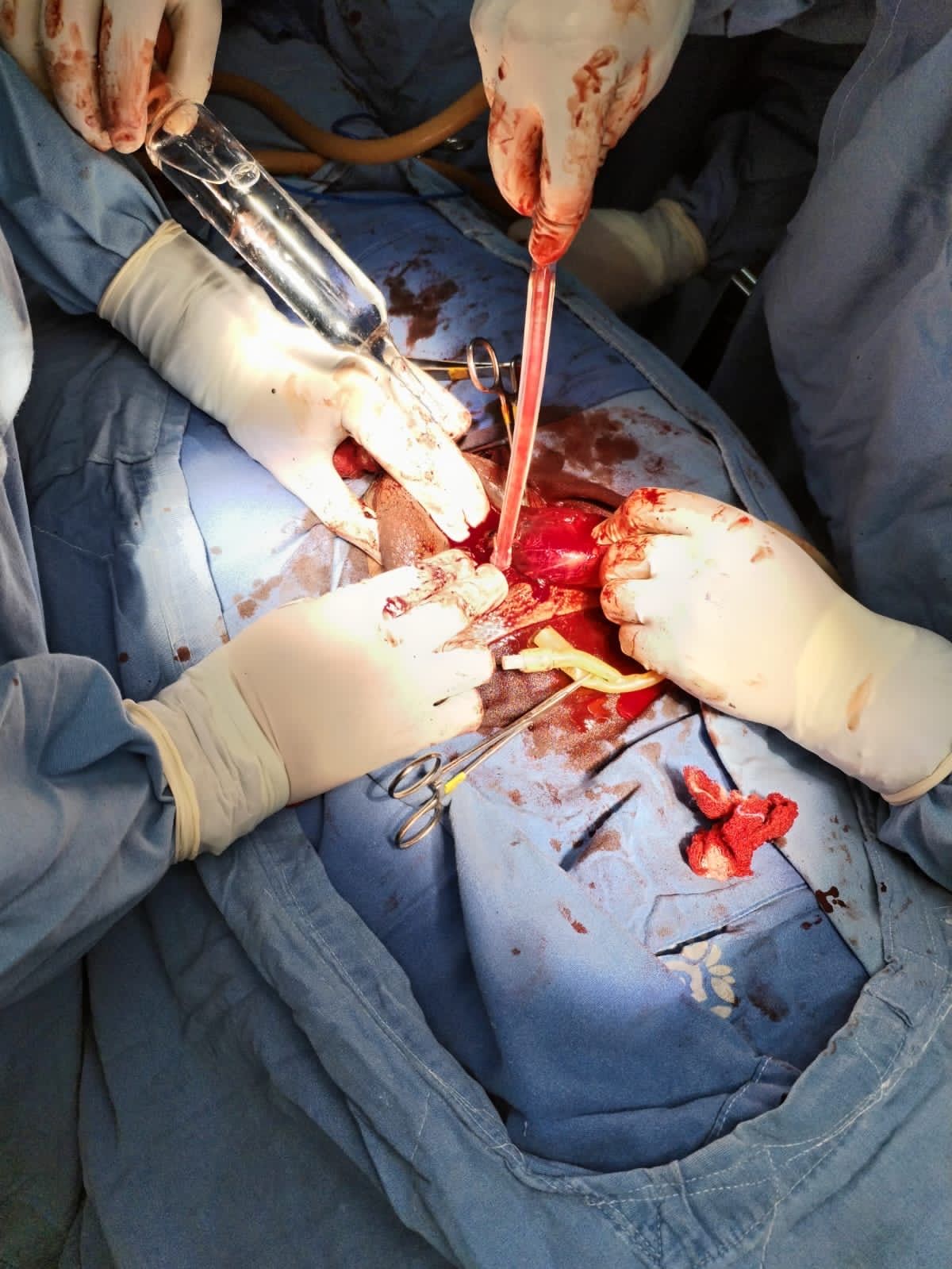 Juan Carlos Camacho Carvajal-14