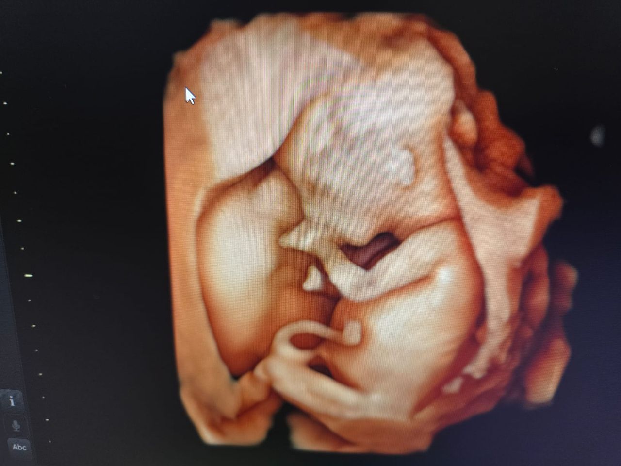 Abraham Ignacio Pérez De La Rosa-4