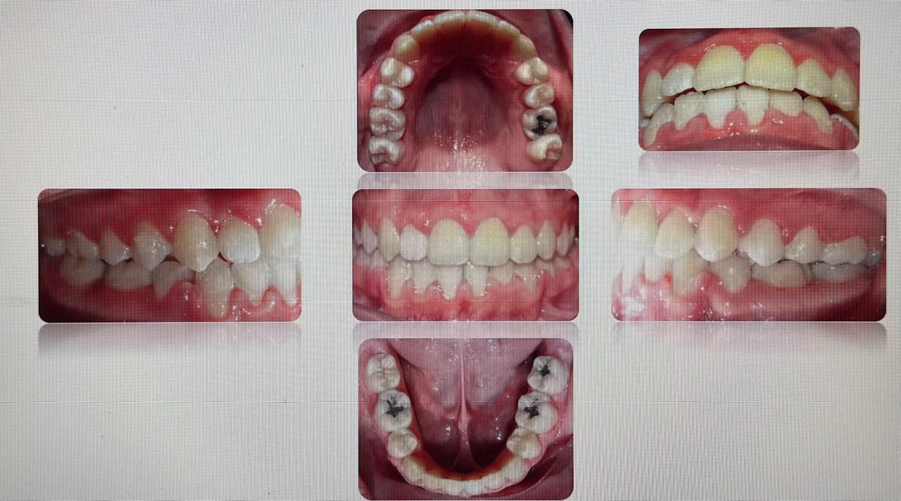 Antonio Gomez Arenas-12