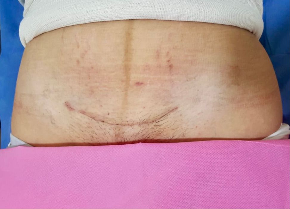 Ángel Millán Juárez-30