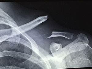 Victor Adrian López López-3