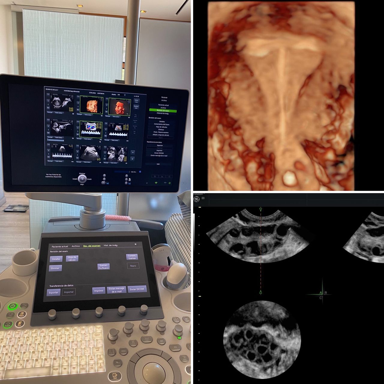 Kevin Aguirre Castro-4