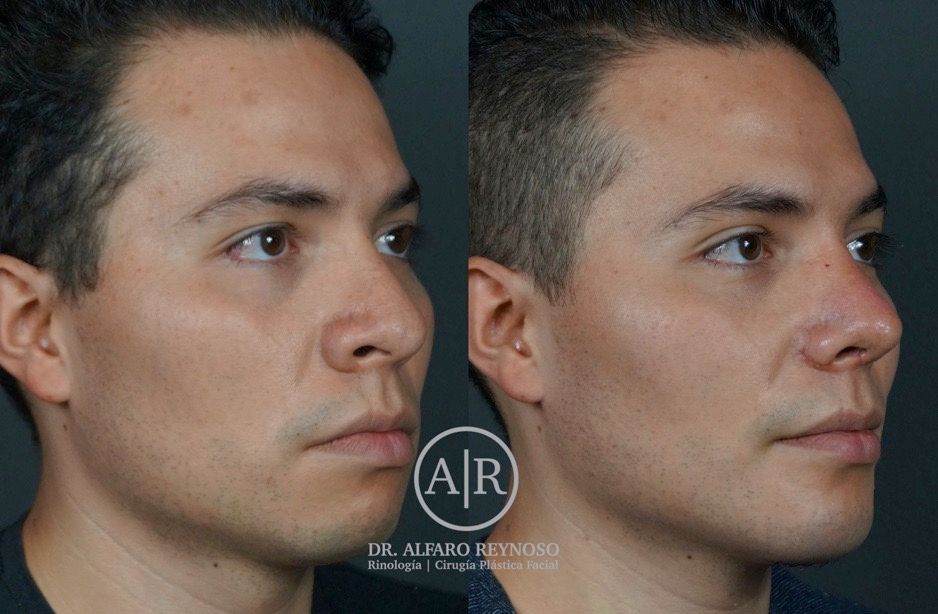 Jose Alberto Alfaro Reynoso-7