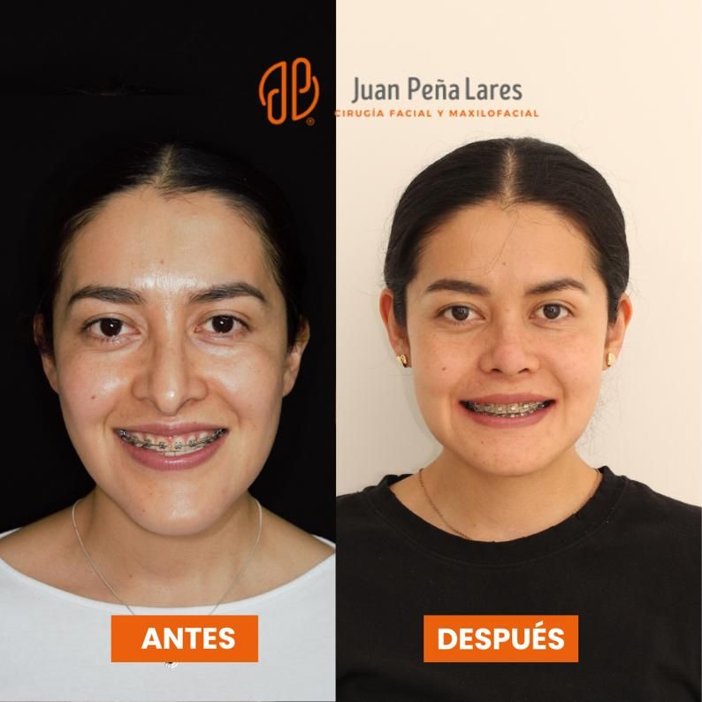 Juan Peña Lares-17