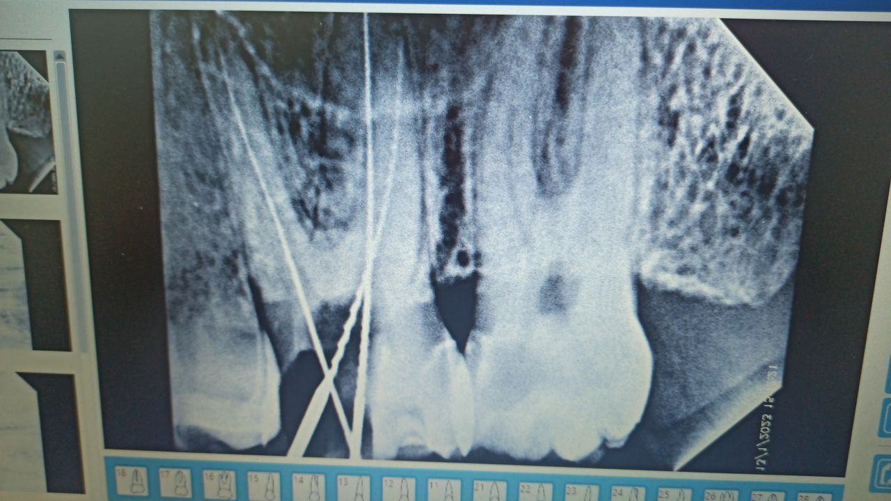 Oscar Cortez Perez-11
