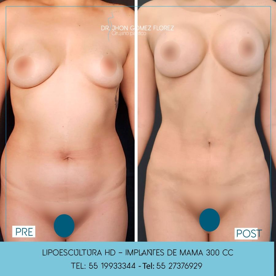 Jhon César Gómez Florez-21