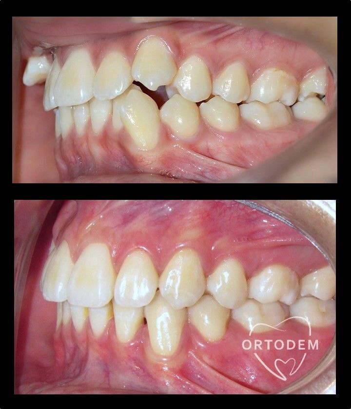 Elizabeth Morelos Morales-11