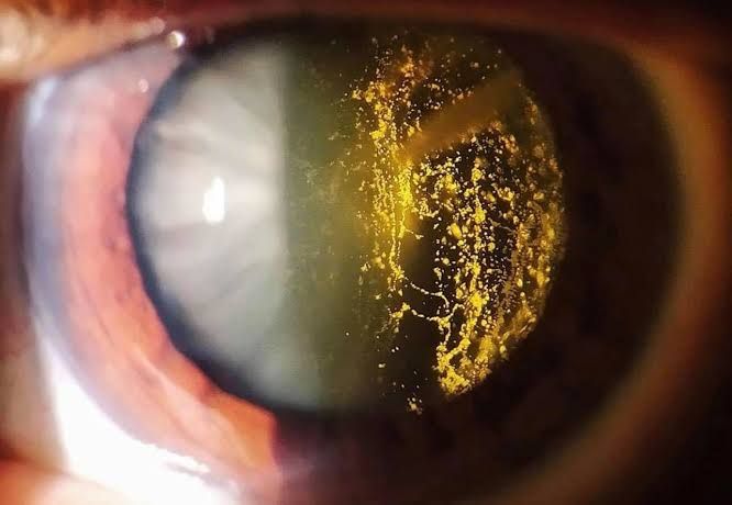 Álvaro Garza Arreola-7