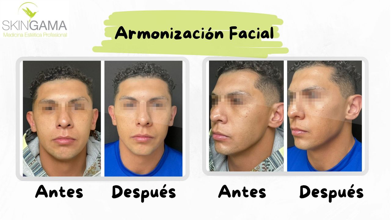 Juan Herrera Hernández-60