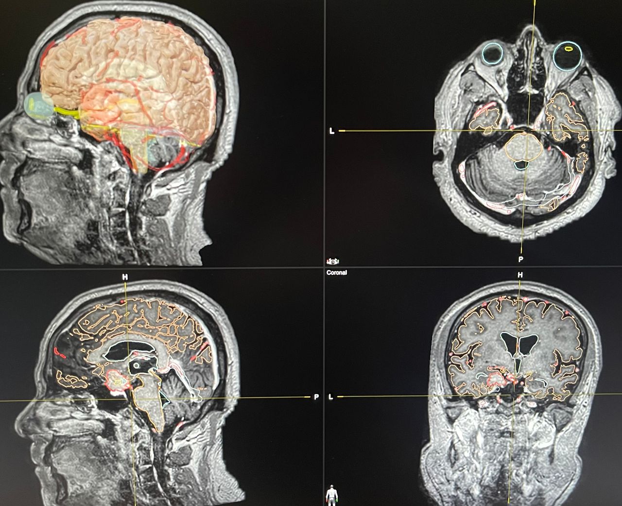 Juan Antonio Alvaro Heredia-1