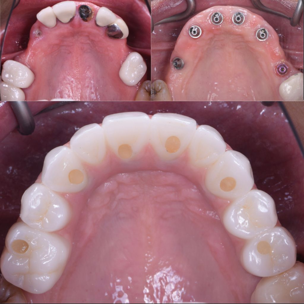 Ricardo López Lemus-133