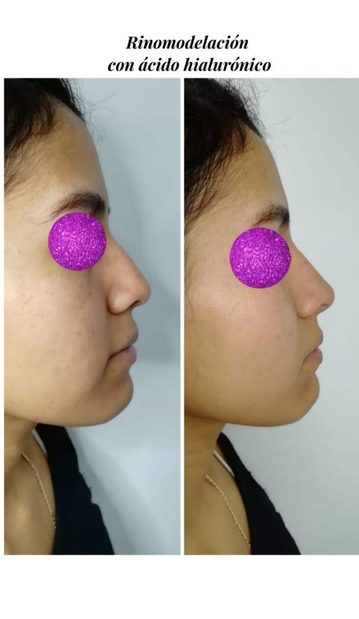 Ana Díaz Noriega-16