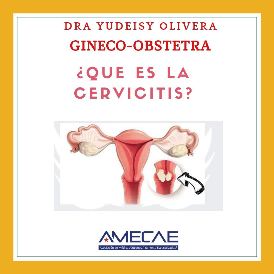 Yudeisy Olivera Gil-20