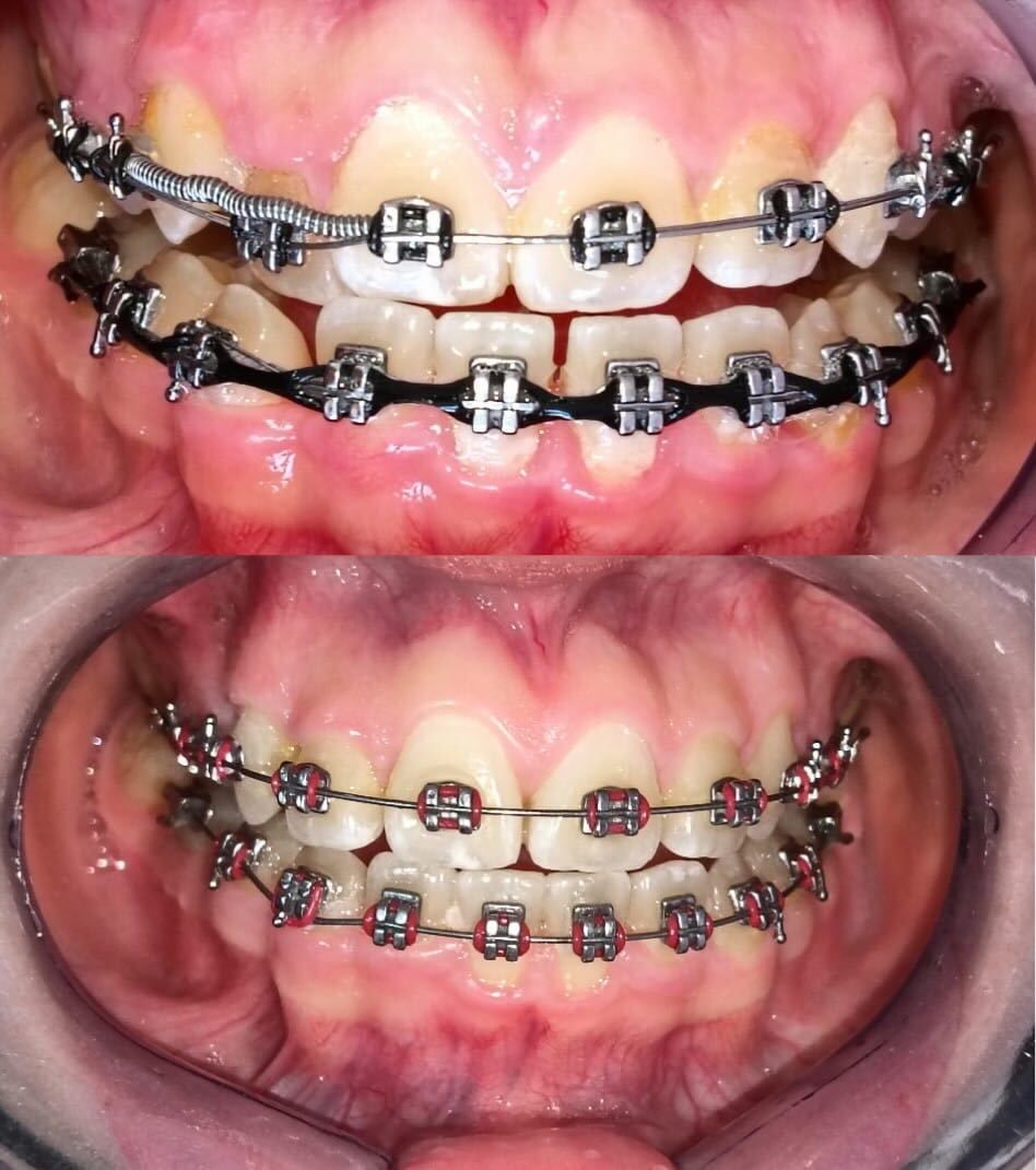 Luz Anel Valente Lozano-12