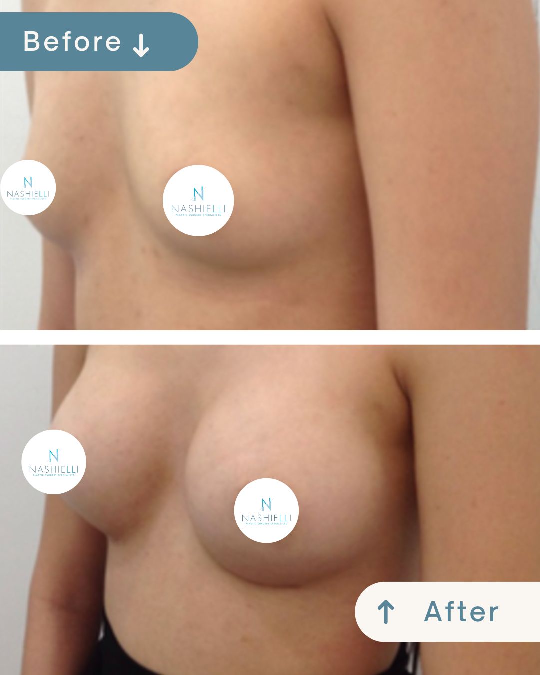 Nashielli Torres Espinosa Chiu-42