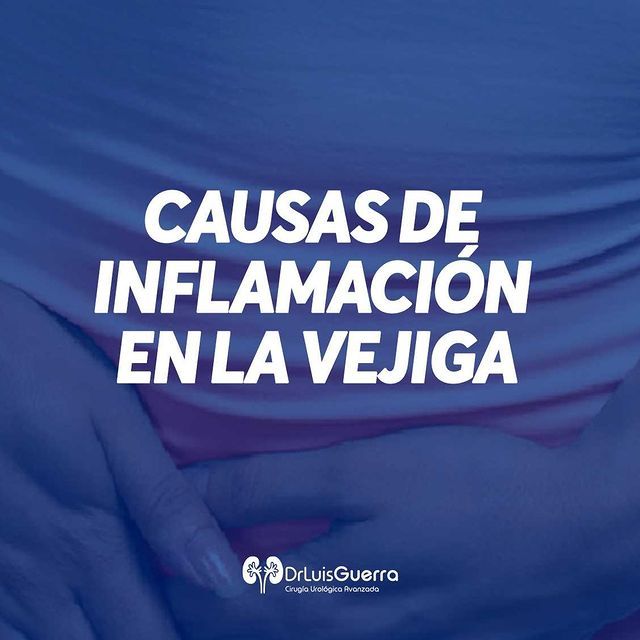 Luis Alberto Guerra Zepeda-174