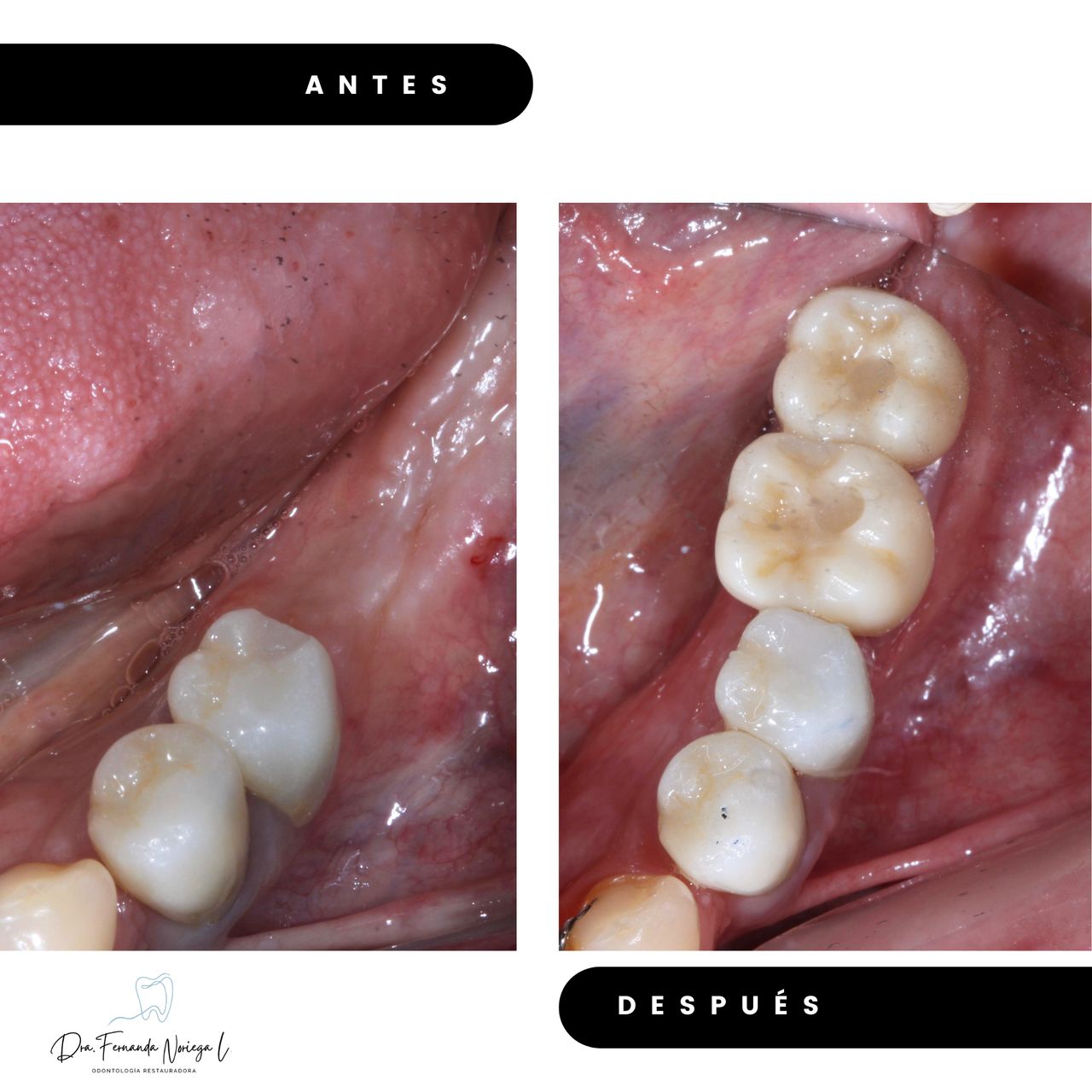 Fernanda Noriega Limón-6