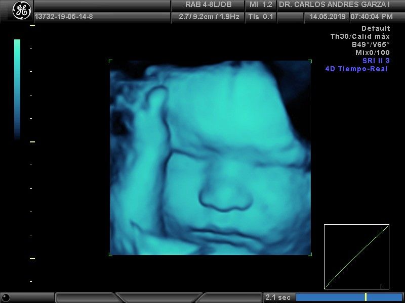 Carlos Andrés Garza Flores-6