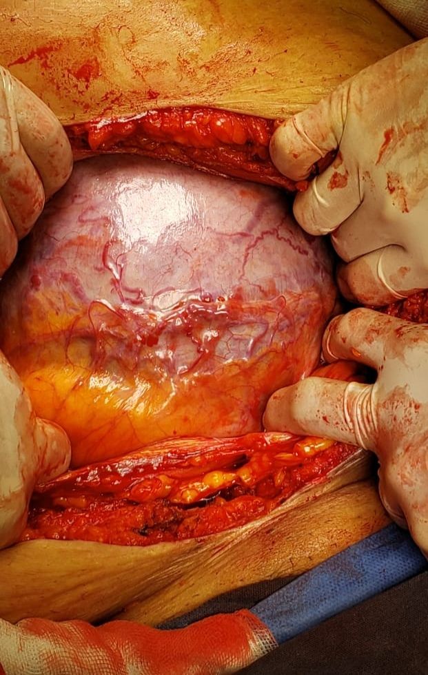 Marisol I. Alvarez Carrasco-27