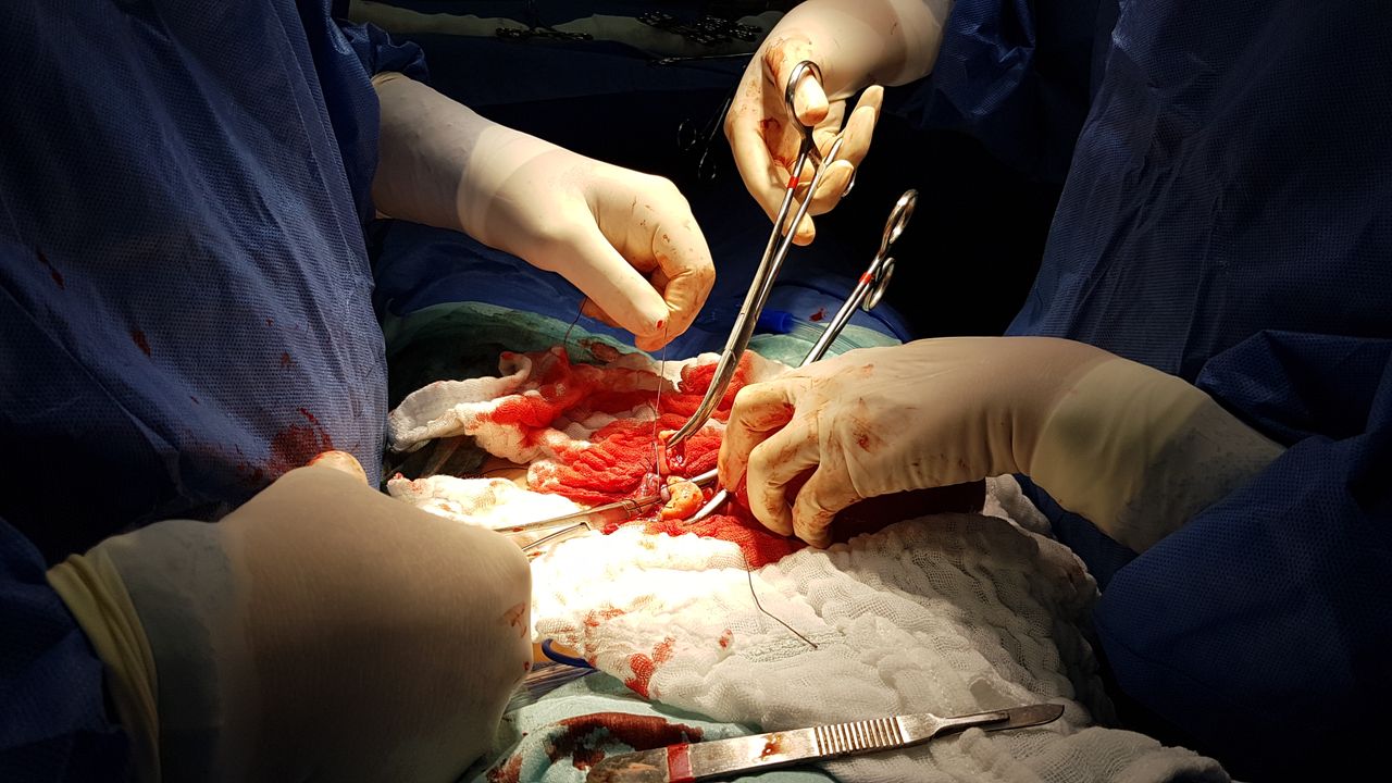 Yudeisy Olivera Gil-16