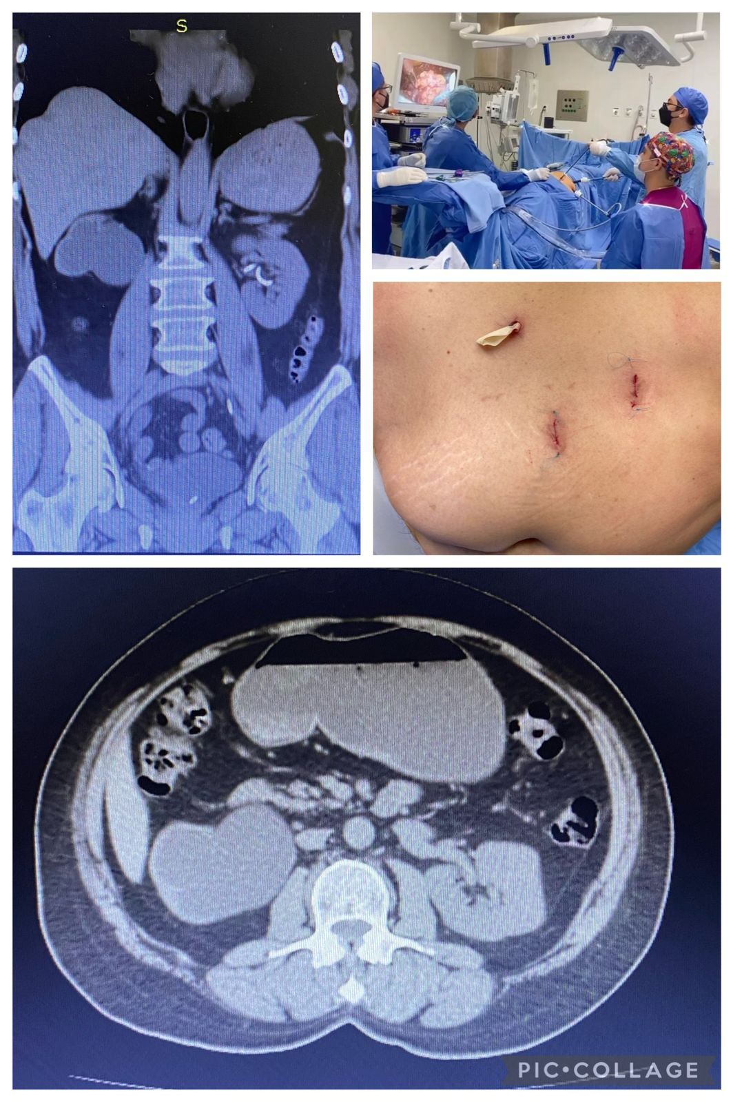 Ricardo Pérez Huerta-20