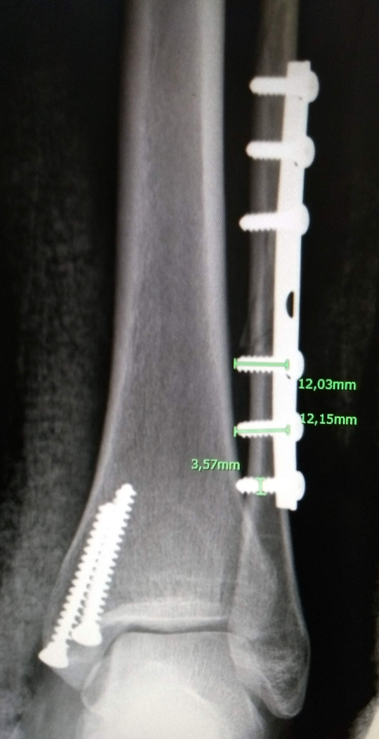 Rubén Rodriguez Acosta-5