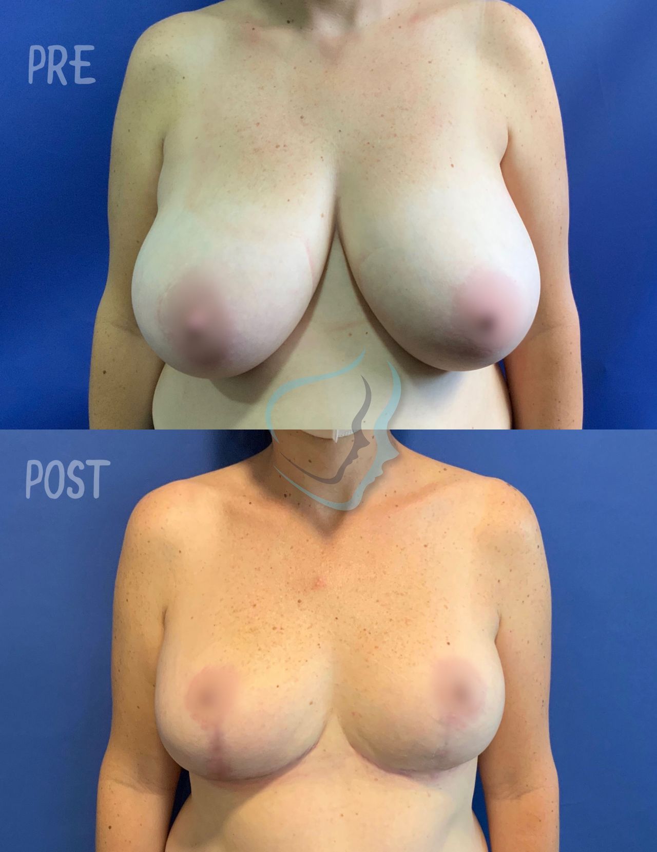 Giuseppe Tanzillo-54