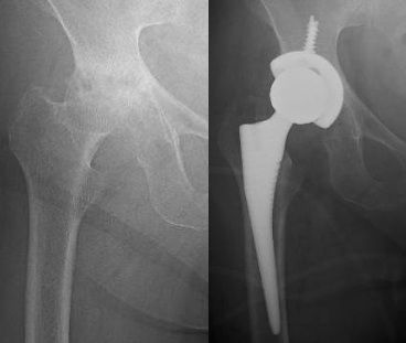 Luis Castañón Robles-24