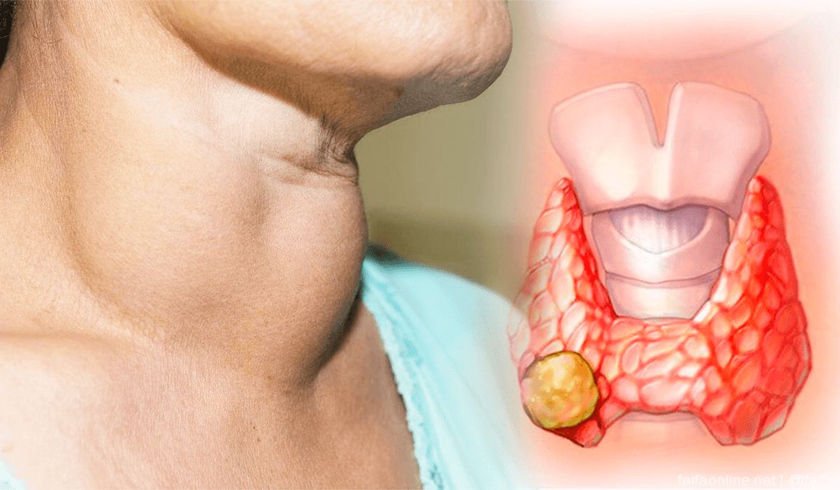 Carlos Cordero Vargas-20