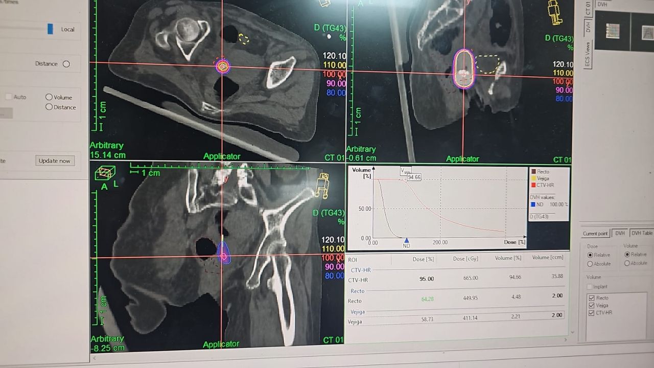 Emmanuel Hernández Bahena-17