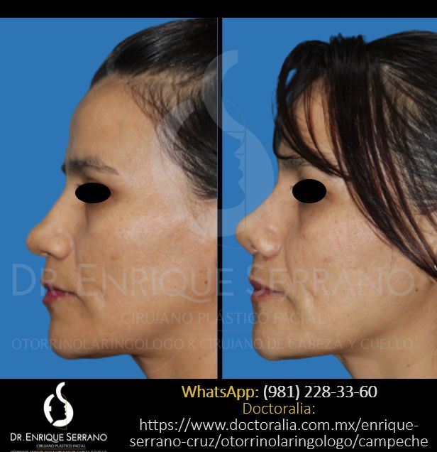 Enrique Serrano Cruz-55