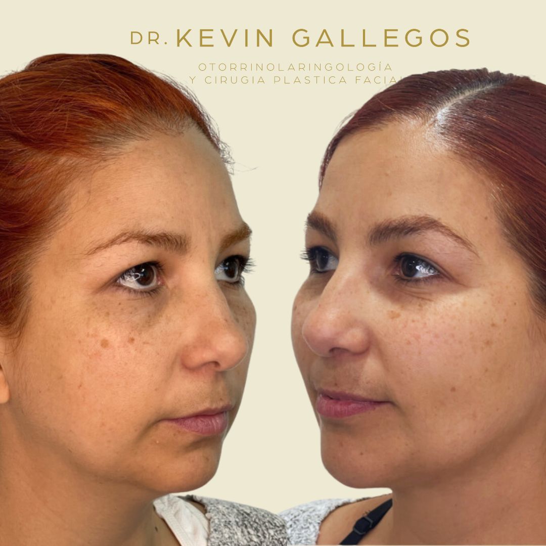 Kevin Iram Gallegos Montero-3