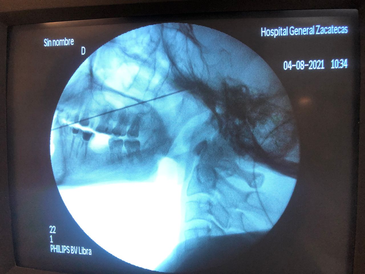 Liber Abdel Arenas Garcia-2