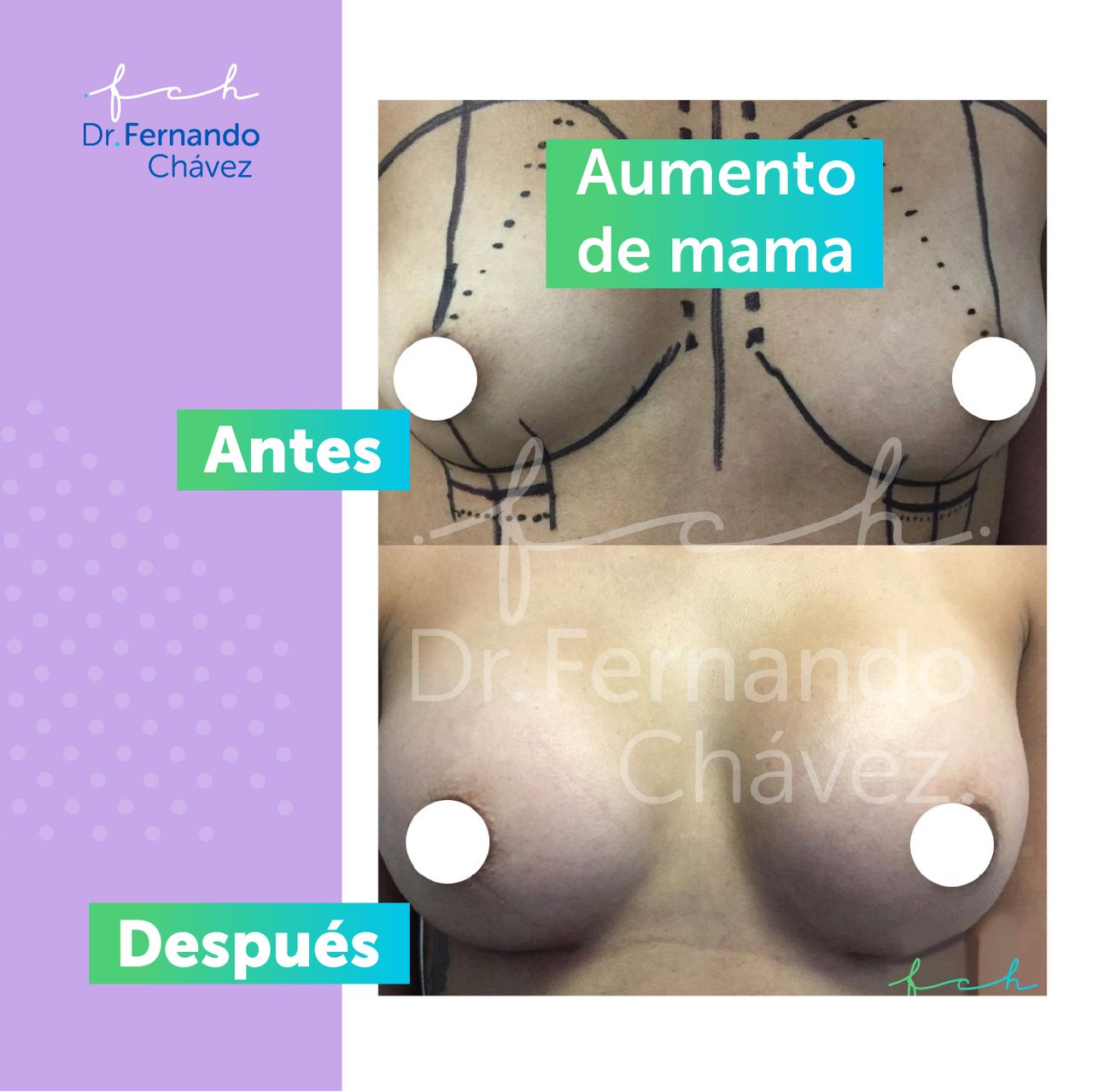 Fernando Chávez Osorio-20