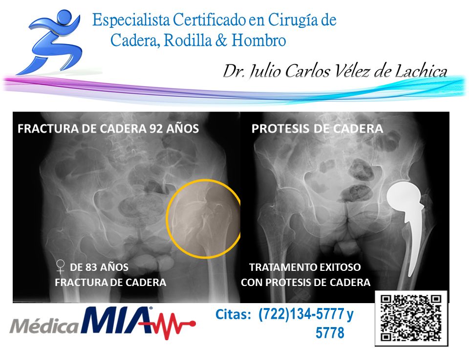 Julio Carlos Vélez De Lachica-37