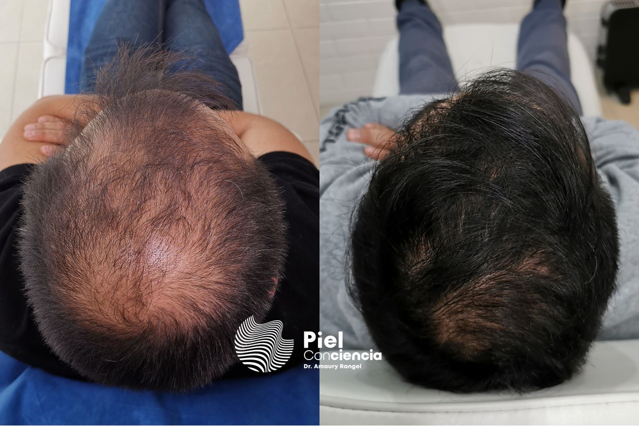 Víctor Amaury Rangel Avilés-24