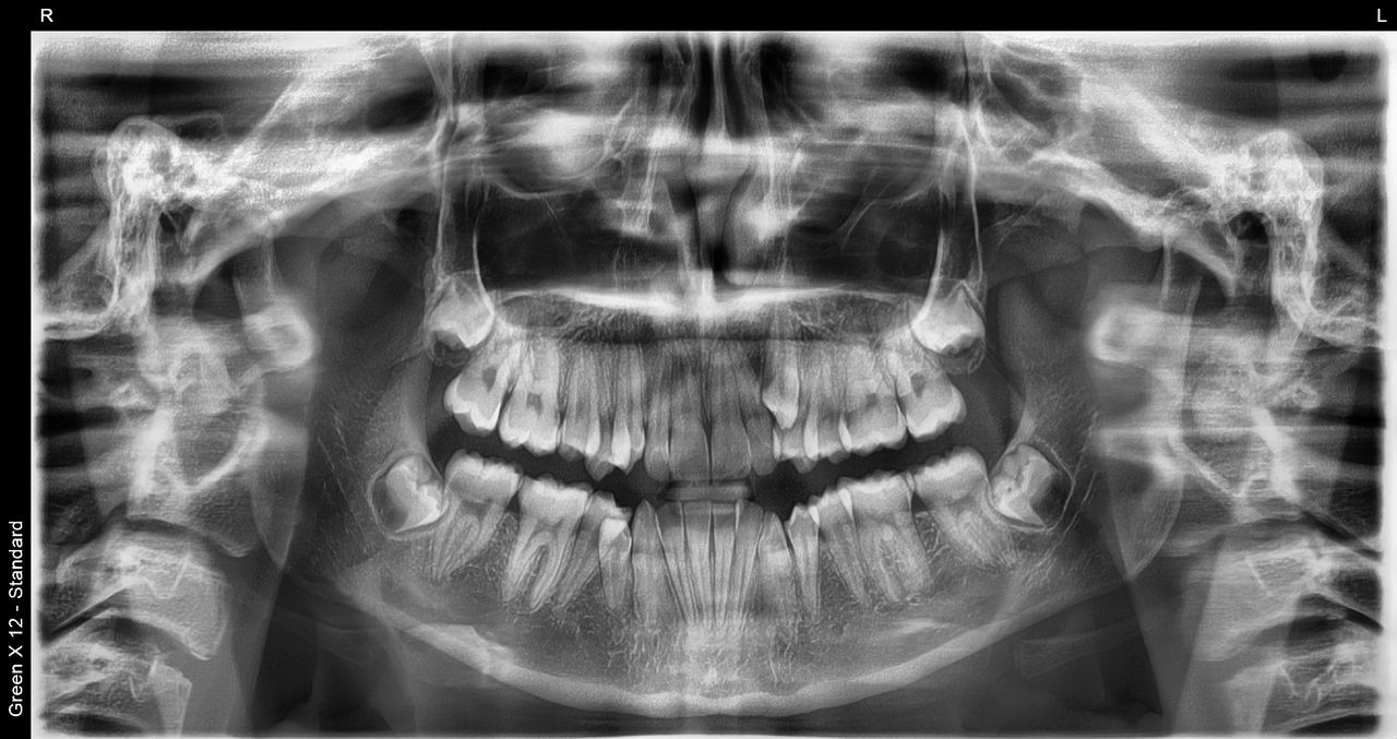 Francisco Alejandro Poblano Vázquez-3