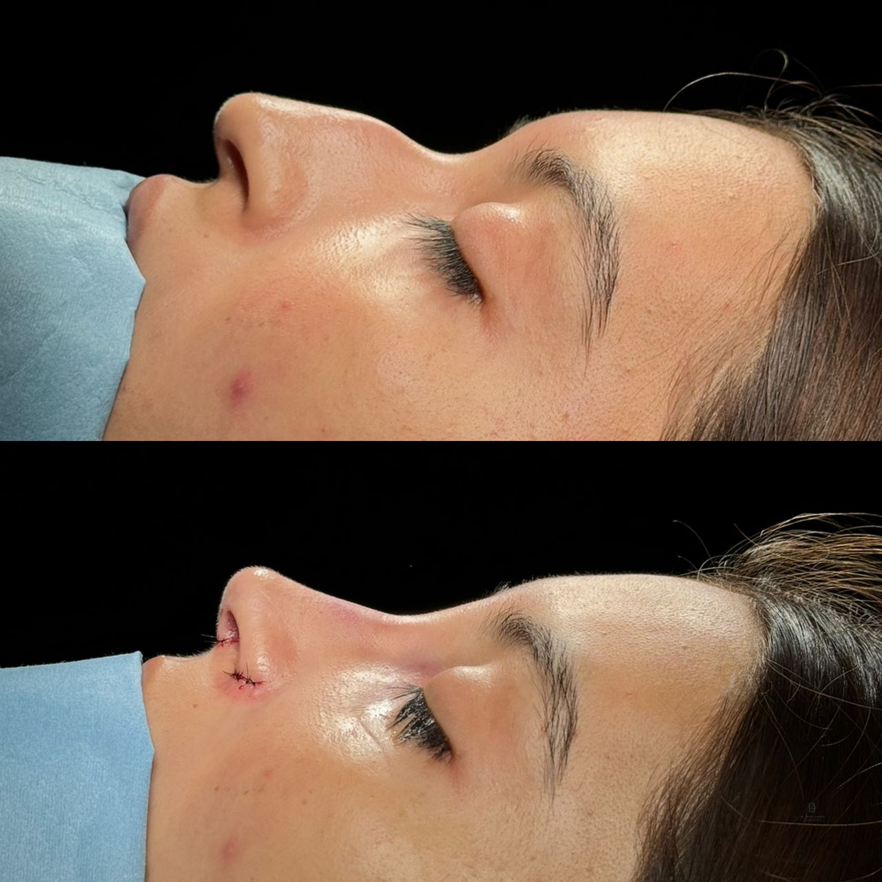 Angel Castro Urquizo-23