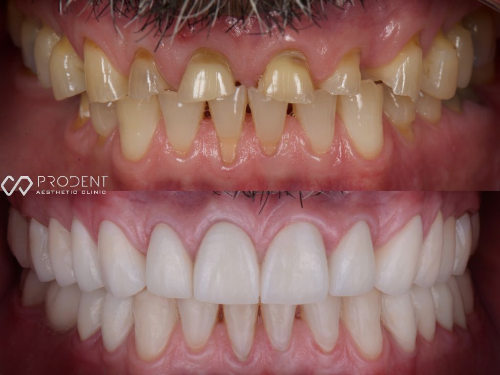 Ulises Pérez Murillo-74