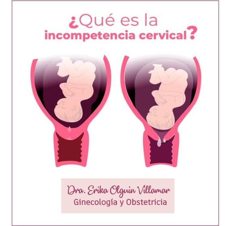 Erika Olguín Villamar-20