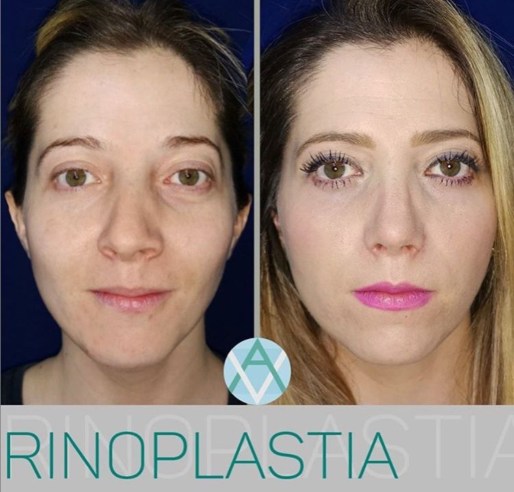 Alfonso Villaseñor Herrero-19